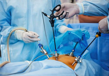 Surgery